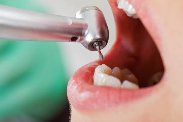 Best Root Canal Emergency Dentist  in Cliffwood Beach, NJ